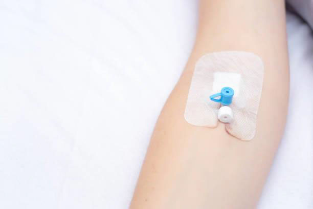 Advanced IV Cannula Features for Safer Infusion