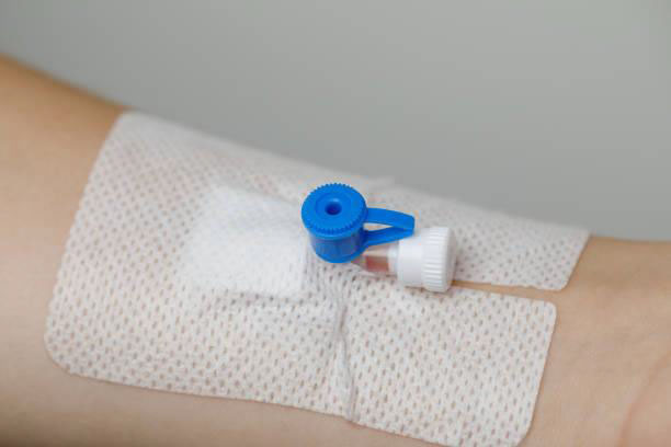 Safe IV Cannulas for Hospitals ISO-Certified IV Cannula Manufacturer in India